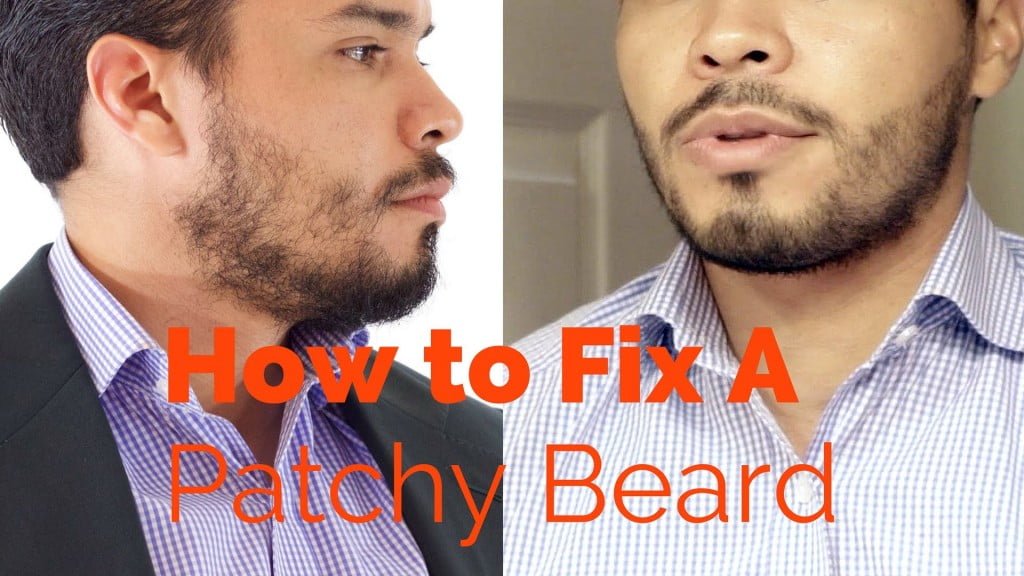 fix patchy beard