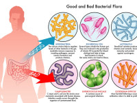 Probiotics: Keep Your Bacteria Happy and They Will Keep You Healthy