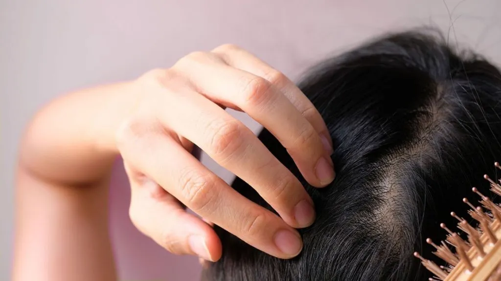 Science-Backed Hair Loss Treatments